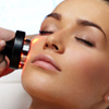 CACI Synergy non-surgical facelift